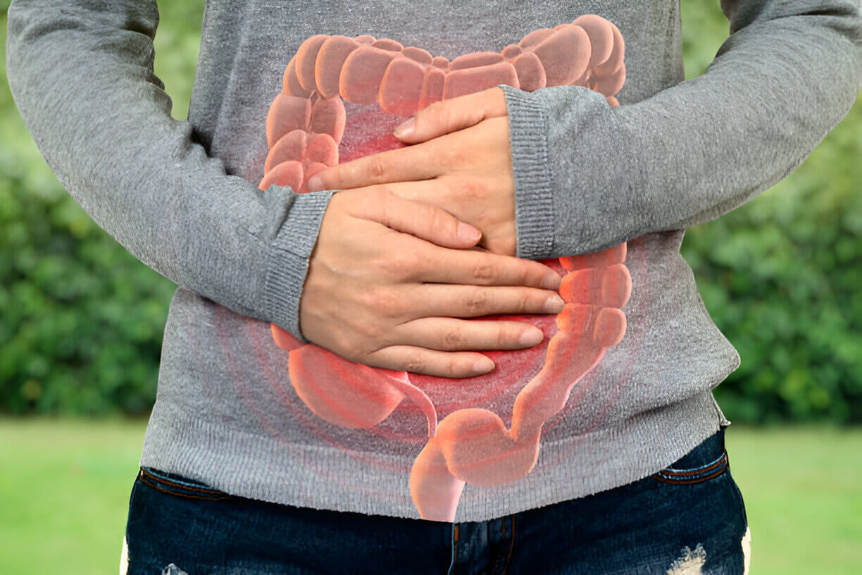 Check-Up Doença de Crohn